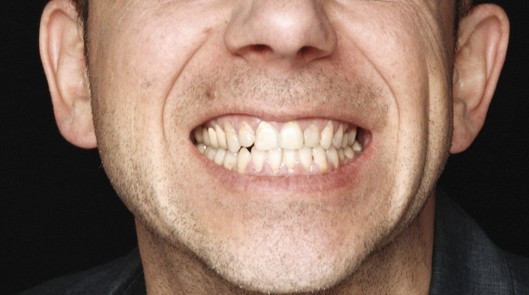 How Do I Get Over My A**hole Ex? — The Bold Italic — San Francisco