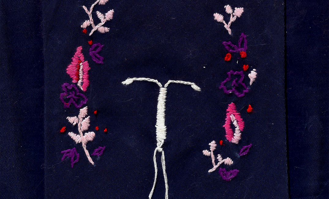 My Body Hates My IUD — But It Was Still Worth It