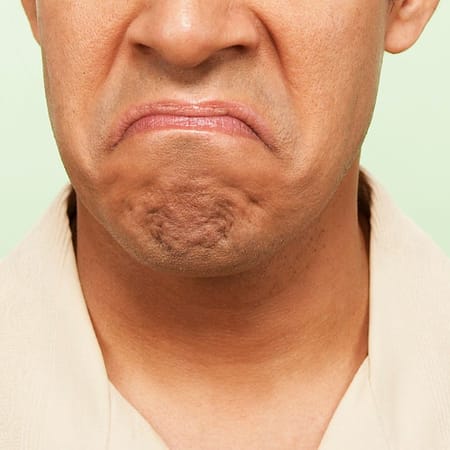 Image of: How Do I Get Past the Fact That My Partner Gave Me an STI?