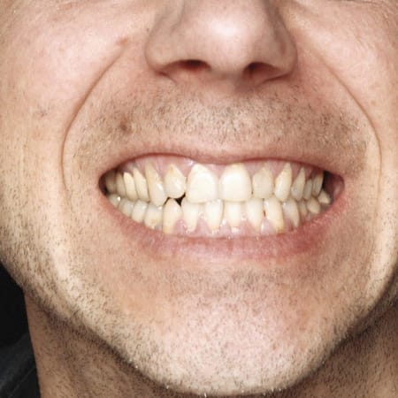 Image of: How Do I Get Over My A**hole Ex? — The Bold Italic — San Francisco