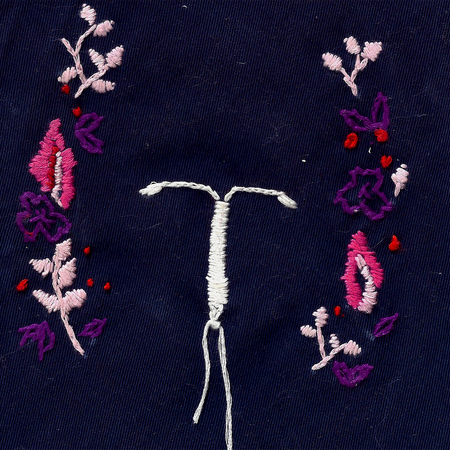 Image of: My Body Hates My IUD — But It Was Still Worth It